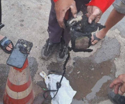 Power Bank Dalam Tas Meledak, Wanita Ini Terbakar hingga Bagian Wajah