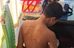 Anak Jalanan yang Diduga Dianiaya Oknum Konselor Rehabilitas, Lapor Polisi