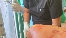 Seorang Pria Tewas Akibat Luka Bacok dan Tikaman di Kompleks Pelabuhan 