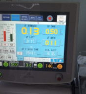 Tidak Semua Pasien Gagal Ginjal Harus Cuci Darah