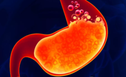 Puasa Sembuhkan Asam Lambung