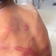 Video Tubuh Anak dengan Punggung penuh Luka