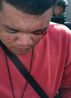 Pengendara Bawa Anak Kecil Luka di Wajah, Diduga Dipukul Oknum TNI di Frontage Tebel
