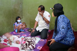 Sambangi Bayi Elora Penderita Hidrosefalus, Armuji Teteskan Air Mata