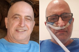 Aktivis Anti Masker dan Vaksin, Meningga karena Covid 19