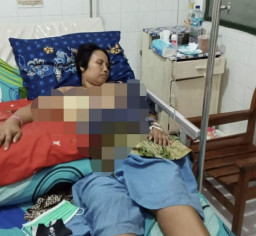 Miris! Penderita Kanker Payudara Stadium 4, Tak Tersentuh Bantuan Pemkab Jember