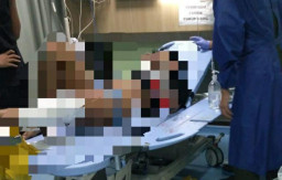 ABG Mau Jual HP, Dibacok lalu Disiram Air Keras