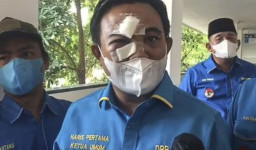 Haris Pertama Hadiri Sidang Ferdinand Hutahaean, dengan Wajah Babak Belur