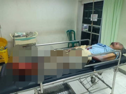 Mercon Racikan Meledak, Pria di Ponorogo Luka Parah