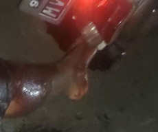 Tabrak Mobil Mogok tanpa Lampu Isyarat, Pengendara Motor di Depok Luka Parah