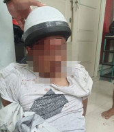 Kepergok Curi Motor di Dukuh Kupang, Pemuda Asal Tandes Surabaya Babak Belur