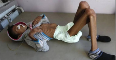 214 Orang  Meninggal Kena Kolera