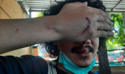 Editor Detik.com Jadi Korban Pengeroyokan Orang Tidak Dikenal