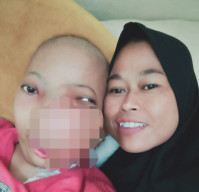 Ibu Si Penderita Tumor Wajah, Minta Uluran Tangan Para Dermawan