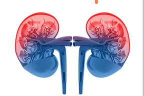 13 Anak di Surabaya Meninggal karena Gagal Ginjal Akut