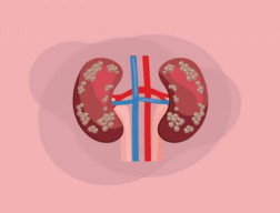 Gejala Khas Gagal Ginjal Akut,  Frekuensi Anak Buang Air Kecil Berkurang