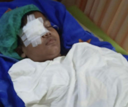 Kena Lato-Lato, Bola Mata Bocah 8 Tahun Pecah