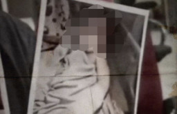 Mau Lepas Perban, Perawat malah Potong Jari Bayi Usia 8 Bulan