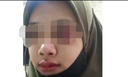 Di-Video Call Teman Pria, Prita Dihajar Suami sampai Babak Belur