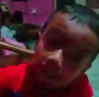 Bocah Lima Tahun Disiksa Teman Pria dari Ibu Kandungnya