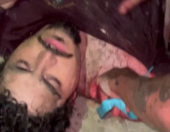 Digigit Buaya Sepanjang 3 Meter, Lengan Pria Ini Putus