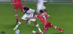 Begini Parahnya Kaki Luciano yang Patah saat Terinjak Marcelo