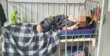 Selamatkan Kucing dari Tabrakan Truk, Kaki Bocah SD Ini Terpaksa Diamputasi