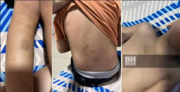 Guru TK Aniaya Muridnya Dibalas Dihajar Orang Tua Si Siswa