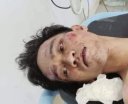 Bapak dan Anaknya Dibacok, Pelakunya Dihajar Massa