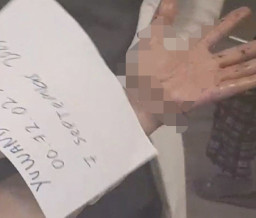 Tangan Adiknya Hampir Putus, Kakak Korban: Nonton Kok Bawa Parang, Ngaco!