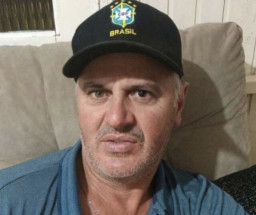 Lagi Asyik Potong Babi, Petani Ini Meninggal karena Pisaunya Kena Pahanya Sendiri