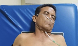 Pulang Kerja, Dada Firdaus Kena Busur