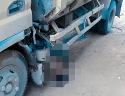 Ditabrak Dump Truk yang Ugal-ugalan, Kaki Pria Ini Putus