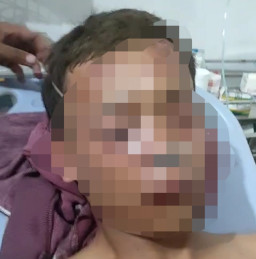 Buntut Penganiayaan Relawan Ganjar, 15 Anggota TNI Ditahan