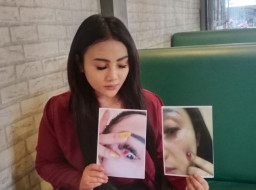 Diduga Aniaya Kekasihnya, Oknum Pegawai PDAM Dilaporkan ke Polisi