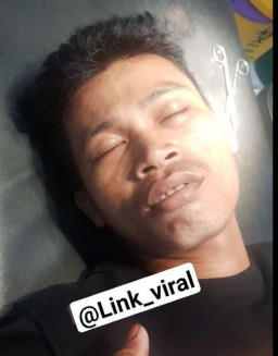 Ngaku Dengar Bisikan Gaib, Pria Ini Potong Kemaluan Sendiri lalu Ditaruh Toples