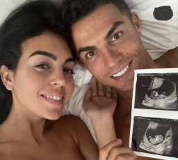 Ronaldo Bakal Punya Anak Kembar dari Pasangan Kumpul Kebonya