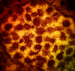 Ini Loh Wajah Virus Covid 19 Varian Delta