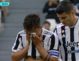 Cidera dan Keluar Lapangan, Dybala Teteskan Air Mata