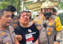 Ade Armanda Berdarah-darah Dihajar Massa