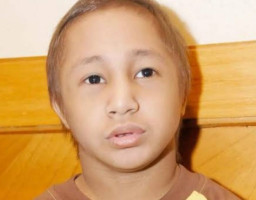 Sudah Dua Tahun Sakit Pembengkakan Jantung, Pesinetron Dicky Topan Wafat