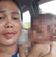 Maunya Bakar Semut, eh Ternyata Badan malah Terbakar