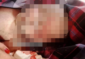 Bocah Perempuan 14 Tahun Melahirkan, Pipi Bayinya Disayat hingga Tewas