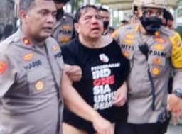 Sudah Pulih, Ade Armando Eksis lagi di Cokro TV