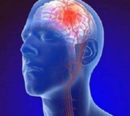 Suka Begadang Picu Stroke