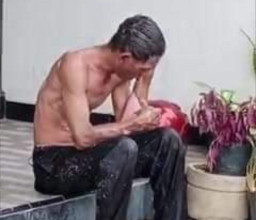 Diserempet Truk, Penjual Bakso Tersiram Kuah Panas hingga Badanya Melepuh