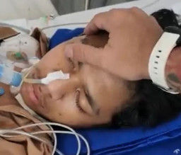 David Ozora Sudah Bisa Membuka Mata secara Sempurna