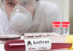 3 Orang Meninggal karena Antraks di Gunun Kidul