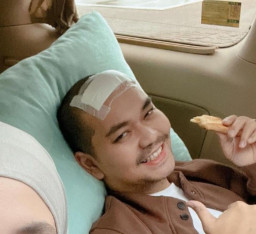 Indra Bekti Diduga Alami Stroke di Mata