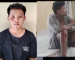 Dua Bocah Bawa Celurit Nyungsep Ditabrak Mobil Korbannya Sendiri
